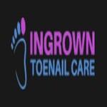 Ingrown Toenail  Care